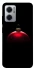 Чехол на Xiaomi Redmi Note 11E Christmas bauble фото 1 из 1