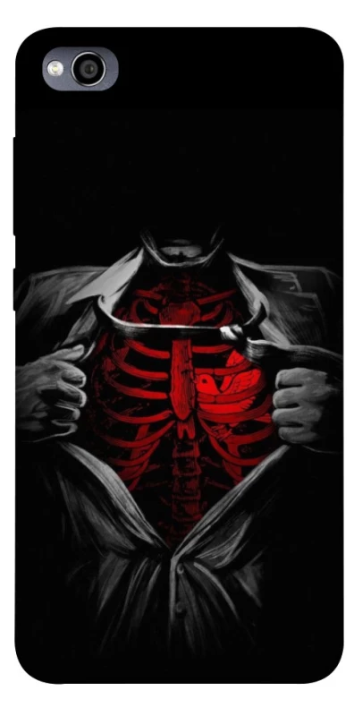 Чехол на Xiaomi Redmi 4a Skeleton Heart фото 1 из 1