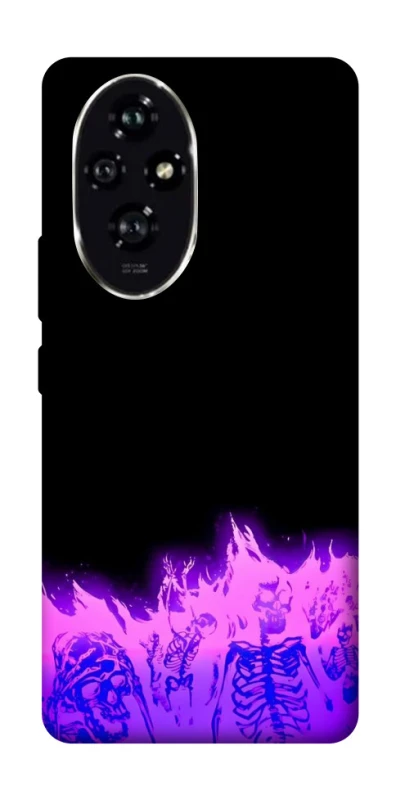 Чохол на Honor 200 Funny moments фото 1 з 1