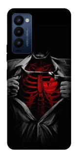 Чохол на TECNO Camon 18 Pro Skeleton Heart фото 1 з 1