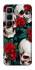 Чохол на Infinix Hot 60 Pro+ skull and rose фото 1 з 1