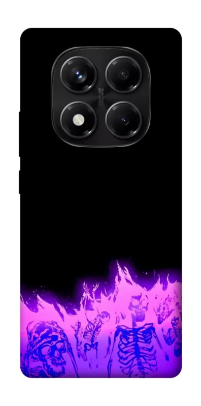 Чехол на Xiaomi Redmi Note 14 Pro 5G Funny moments фото 1 из 1