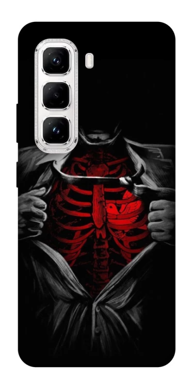 Чохол на Infinix Hot 50 Pro Skeleton Heart фото 1 з 1