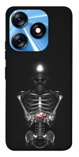 Чохол на TECNO Spark 10 Скелетон фото 1 з 1