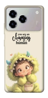 Чохол на ZTE Blade A76 You are amazing фото 1 з 1