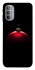 Чохол на Motorola Moto G31 Christmas bauble фото 1 з 1