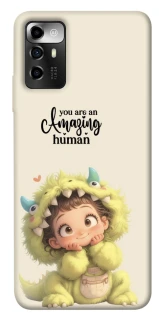 Чохол на ZTE Blade A72 You are amazing фото 1 з 1