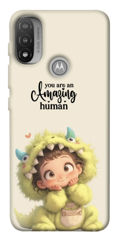 Чохол на Motorola Moto E20 You are amazing фото 1 з 1