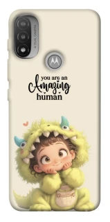 Чохол на Motorola Moto E20 You are amazing фото 1 з 1