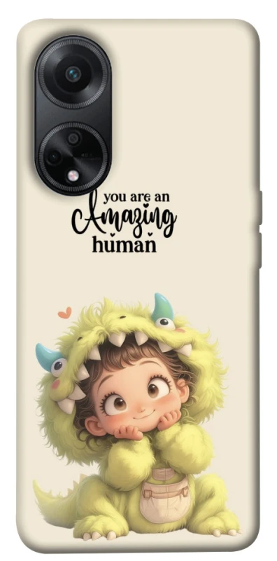Чохол на Oppo A58 4G You are amazing фото 1 з 1