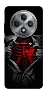 Чохол на Oppo Reno 12 F 4G Skeleton Heart фото 1 з 1