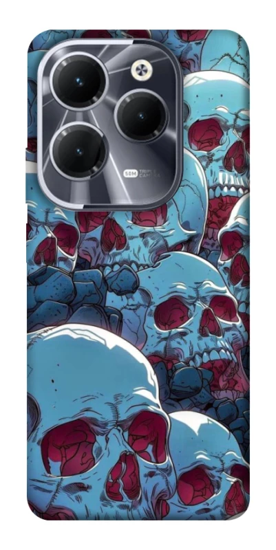 Чехол на Infinix Hot 40 Skulls v2 фото 1 из 1