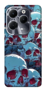 Чехол на Infinix Hot 40 Skulls v2 фото 1 из 1
