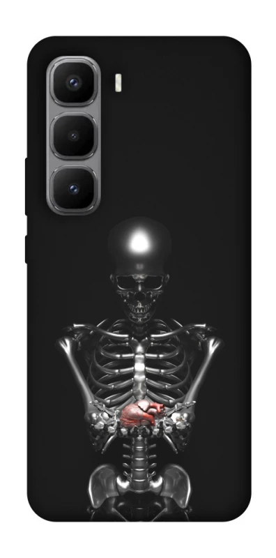 Чехол на Infinix Hot 60 Pro+ Скелетон фото 1 из 1
