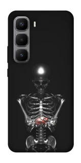 Чохол на Infinix Hot 60 Pro+ Скелетон фото 1 з 1