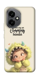 Чохол на Honor 400 You are amazing фото 1 з 1