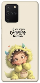 Чохол на Samsung Galaxy S10 Lite You are amazing фото 1 з 1