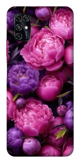 Чохол на ZTE Blade V2020 Smart Garden2 фото 1 з 1