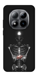 Чохол на Xiaomi Redmi Note 15 Pro 5G Скелетон фото 1 з 1