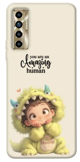 Чохол на TECNO Camon 17P You are amazing фото 1 з 1