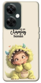 Чохол на OnePlus Nord CE 3 Lite You are amazing фото 1 з 1