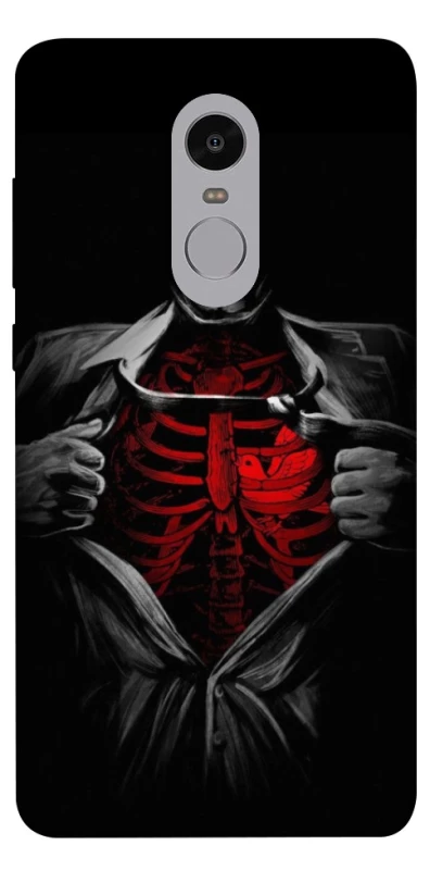 Чохол на Xiaomi Redmi Note 4X / Note 4 (Snapdragon) Skeleton Heart фото 1 з 1