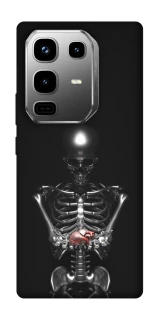 Чохол на Infinix Note 50 Pro Скелетон фото 1 з 1