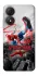 Чехол на ZTE Blade A34 4G Spider Man ver.1 фото 1 из 1