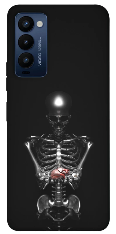 Чехол на TECNO Camon 18 Скелетон фото 1 из 1