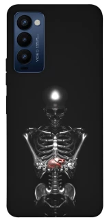 Чехол на TECNO Camon 18 Скелетон фото 1 из 1