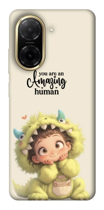 Чохол на Xiaomi Redmi A5 (Europe version) You are amazing фото 1 з 1