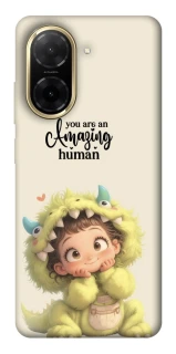 Чохол на Xiaomi Redmi A5 (Europe version) You are amazing фото 1 з 1