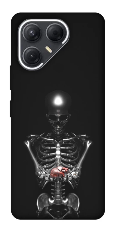 Чохол на TECNO Pova 7 Скелетон фото 1 з 1