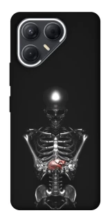 Чохол на TECNO Pova 7 Скелетон фото 1 з 1