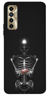 Чохол на TECNO Camon 17P Скелетон фото 1 з 1