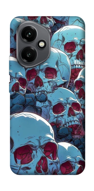 Чехол на Honor 400 Skulls v2 фото 1 из 1