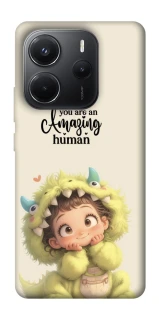 Чохол на Xiaomi Redmi Note 14 4G (Int. version) You are amazing фото 1 з 1