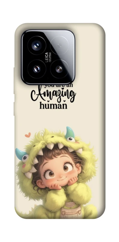 Чохол на Xiaomi 15 You are amazing фото 1 з 1