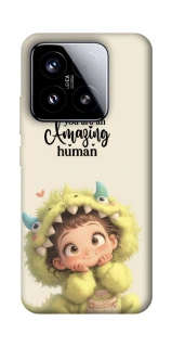 Чохол на Xiaomi 15 You are amazing фото 1 з 1