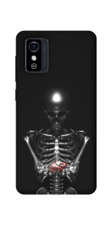 Чохол на ZTE Blade L9 Скелетон фото 1 з 1