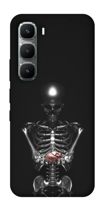 Чехол на Infinix Hot 60 Pro Скелетон фото 1 из 1