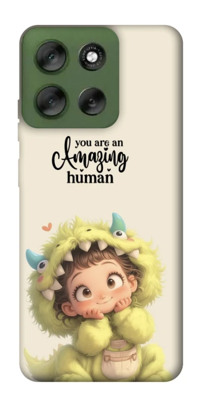 Чохол на Motorola Moto G56 5G You are amazing фото 1 з 1