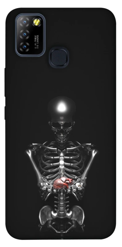 Чехол на Infinix Hot 10 Lite Скелетон фото 1 из 1