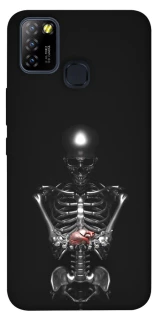 Чохол на Infinix Hot 10 Lite Скелетон фото 1 з 1