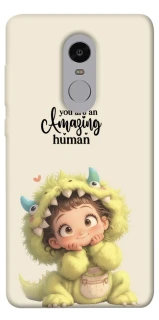 Чохол на Xiaomi Redmi Note 4X / Note 4 (Snapdragon) You are amazing фото 1 з 1