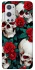 Чохол на OnePlus 9 Pro skull and rose фото 1 з 1