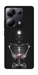 Чехол на Xiaomi Poco M6 Pro 4G Скелетон фото 1 из 1