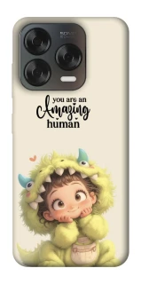 Чохол на ZTE Blade V70 Design You are amazing фото 1 з 2