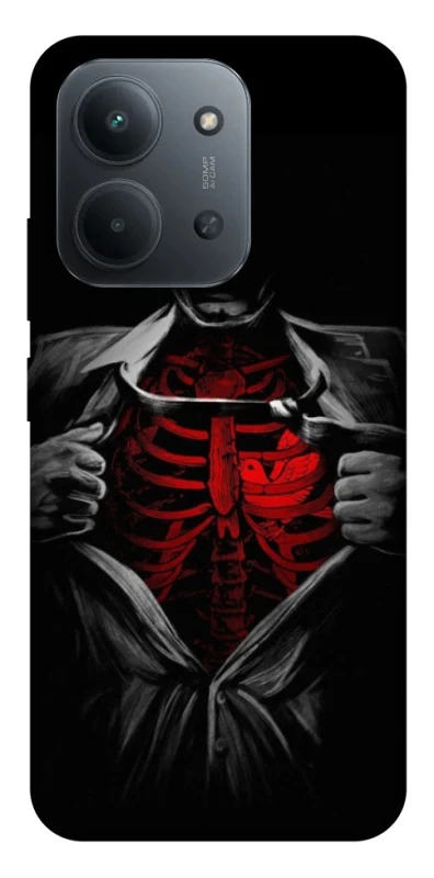 Чохол на Xiaomi Redmi 15C (EU) Skeleton Heart фото 1 з 1