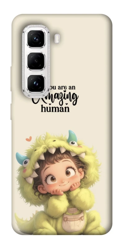 Чохол на Infinix Hot 50 Pro You are amazing фото 1 з 1